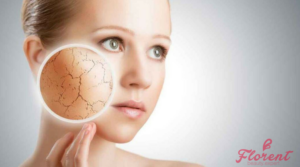 dry skin