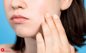 ciri-ciri skin barrier rusak